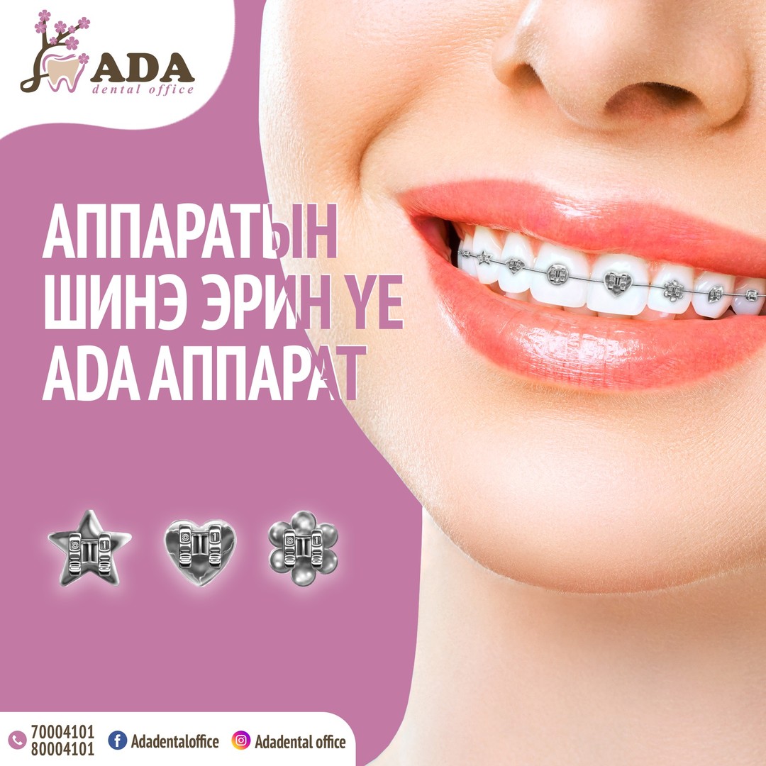 ADA Dental office Шүдний Эмнэлэг Facebook ad