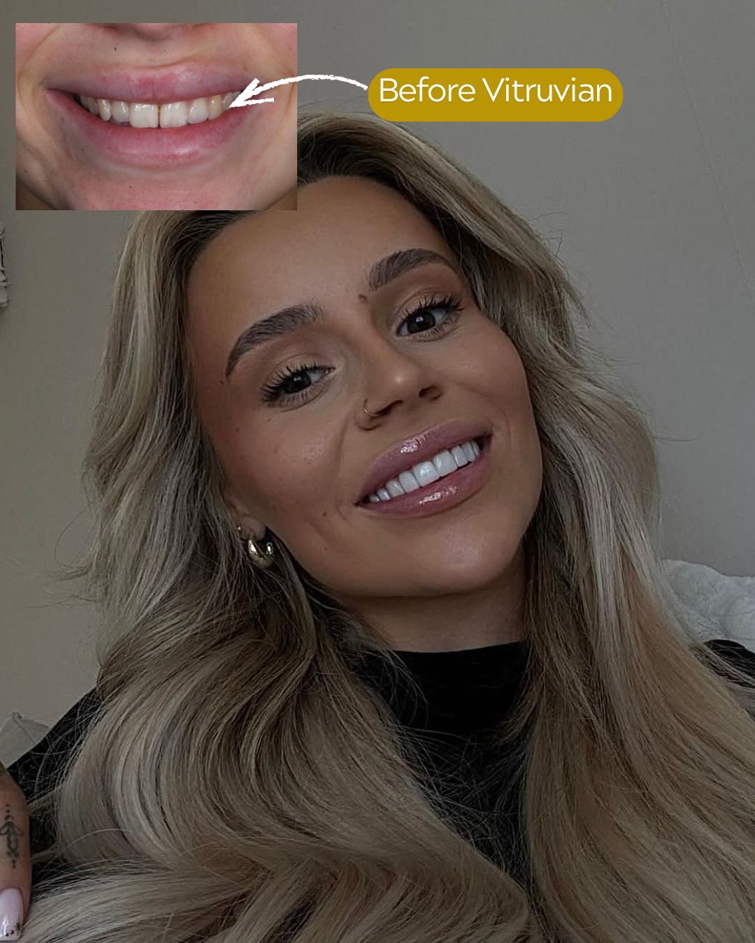 Vitruvian Cosmetic Dentistry and Implant Studio Facebook ad