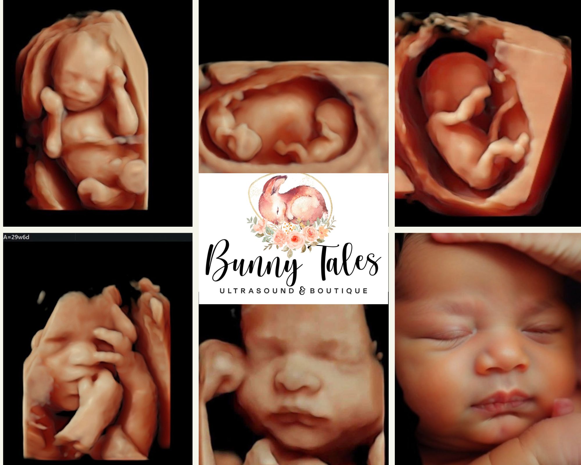 Bunny Tales Ultrasound & Boutique Facebook ad: Bunny Tales Ultrasound & Boutique is an Elective…