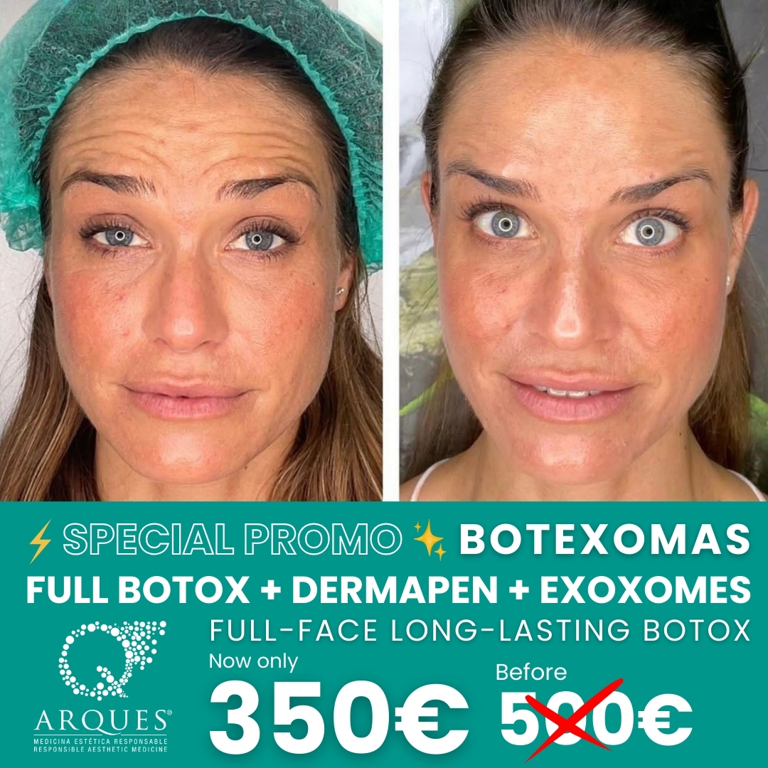 Arques Clinic Marbella Facebook ad: Chatea con nosotros
