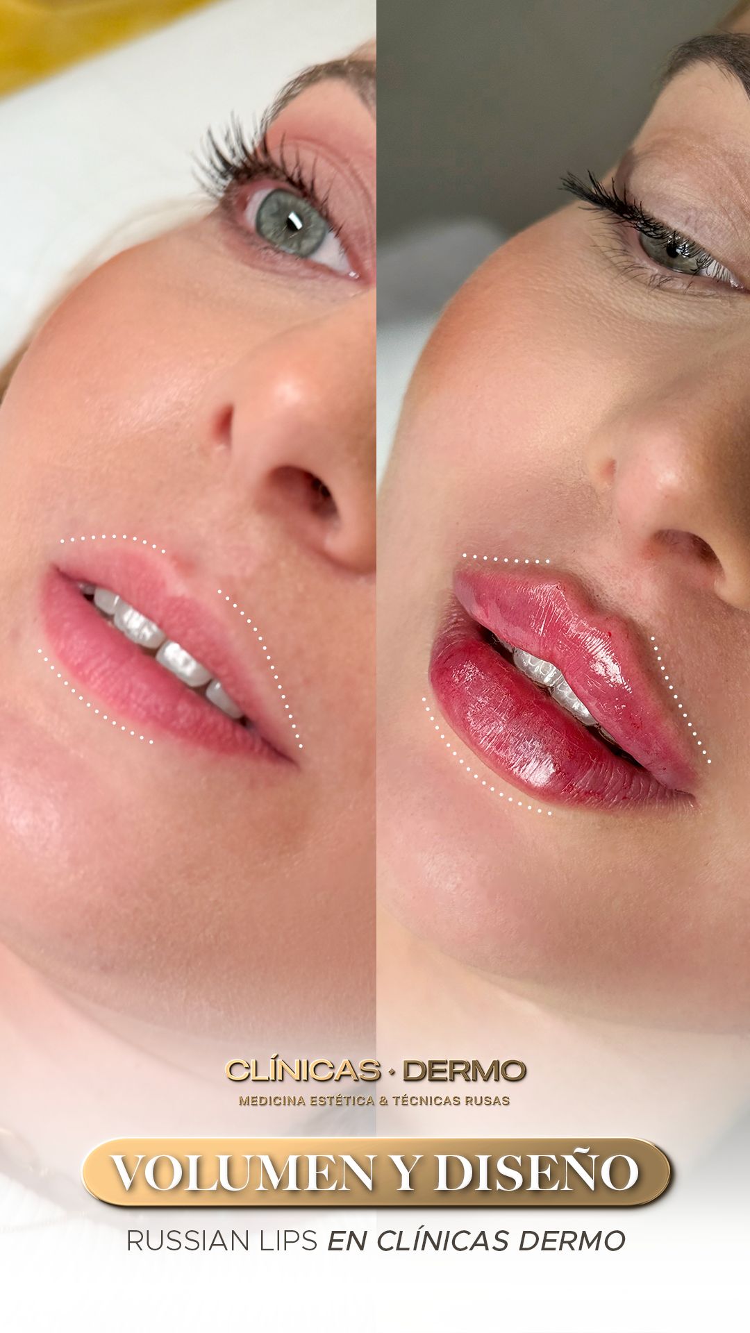 Dermo Clinic Chorbadzhyiiska Facebook ad