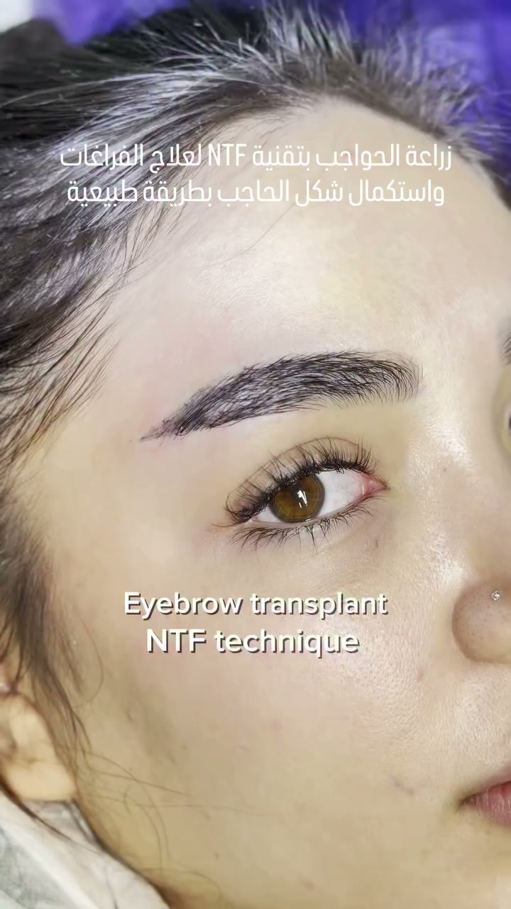 Padra Eyebrow Facebook ad: Book your FREE consultation today.