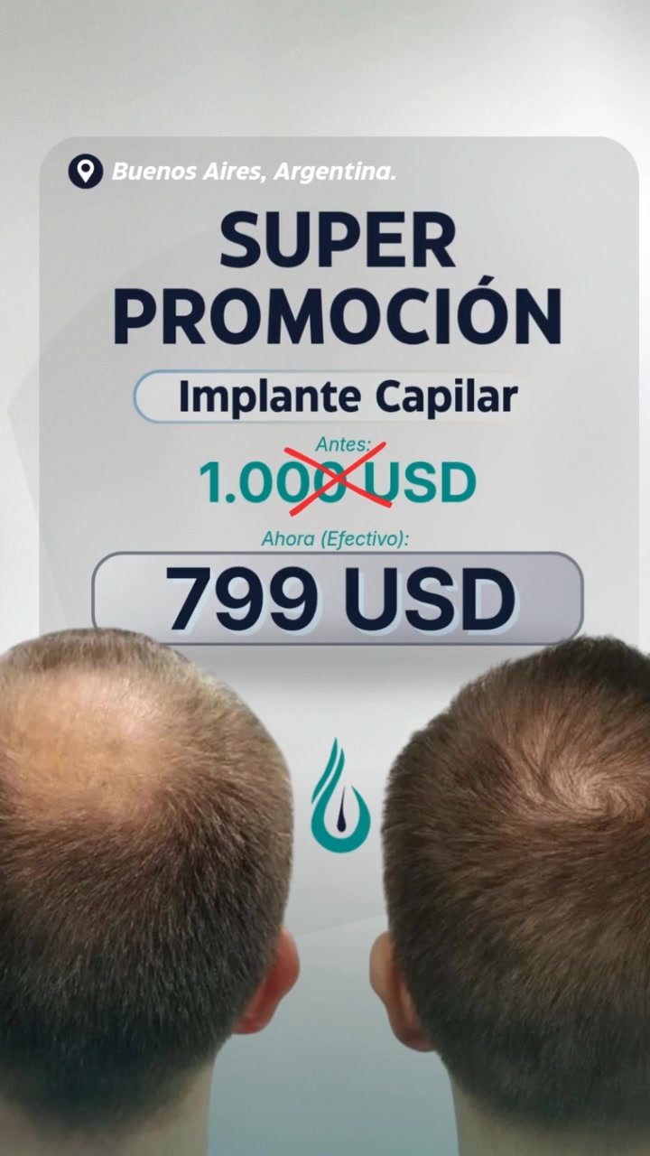 Dermis Capilar Facebook ad: Hacé el cambio hoy