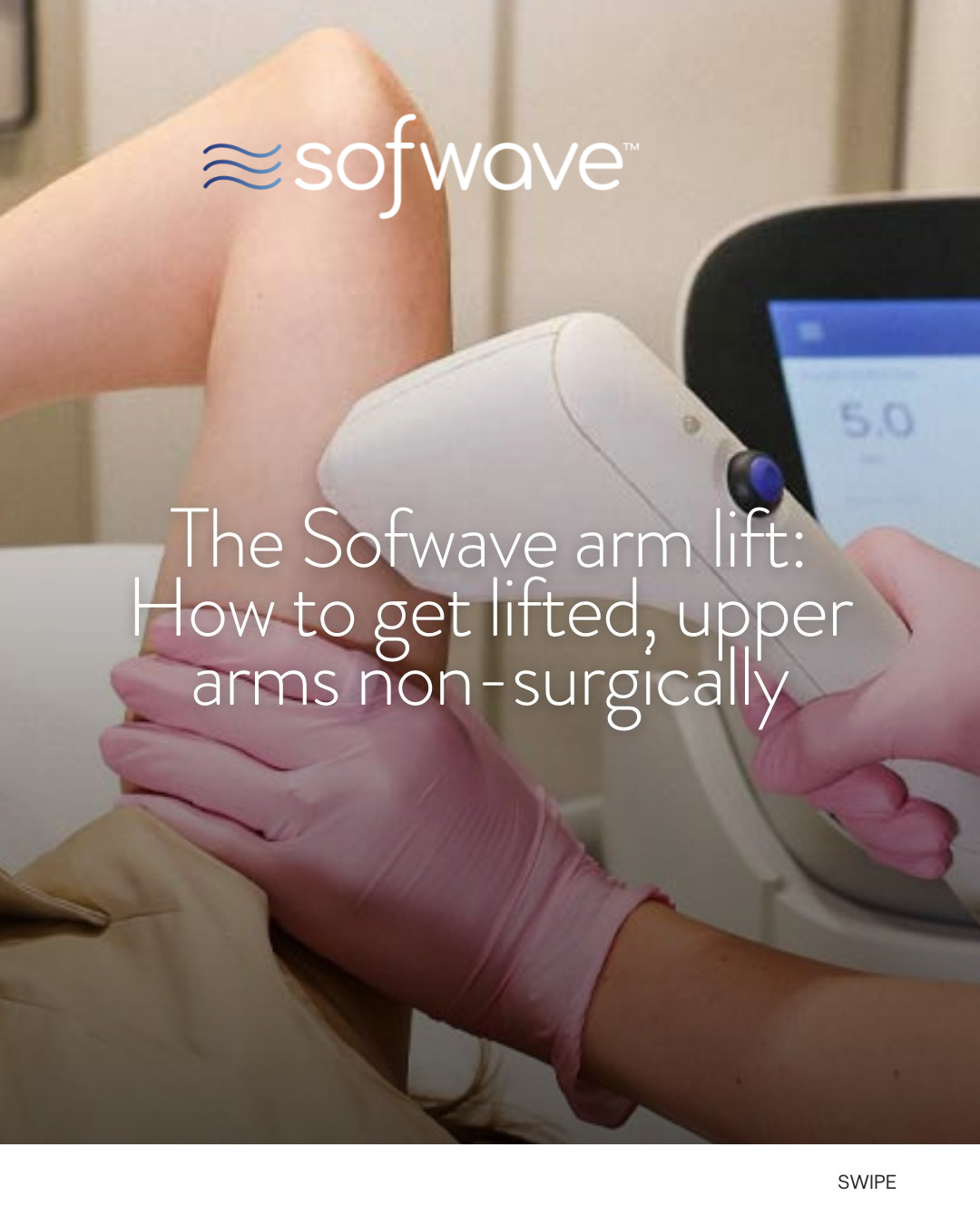 Sofwave UK Facebook ad