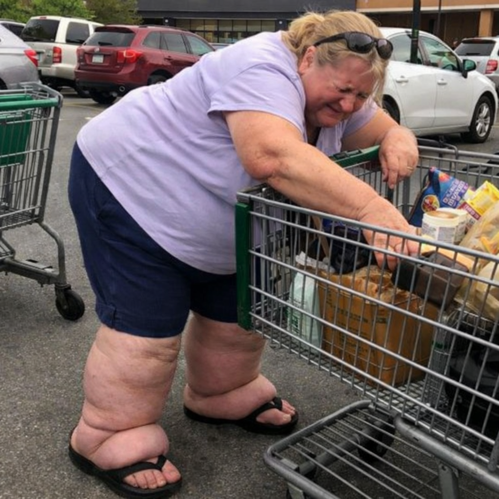 Mary Edwards Facebook ad: What Your Swollen Ankles Are Telling You