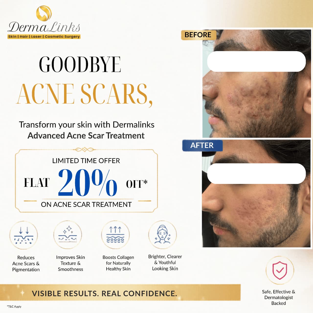 Dr. Vidushi Jain Facebook ad: Say Goodbye to Acne Scars & Hello to…