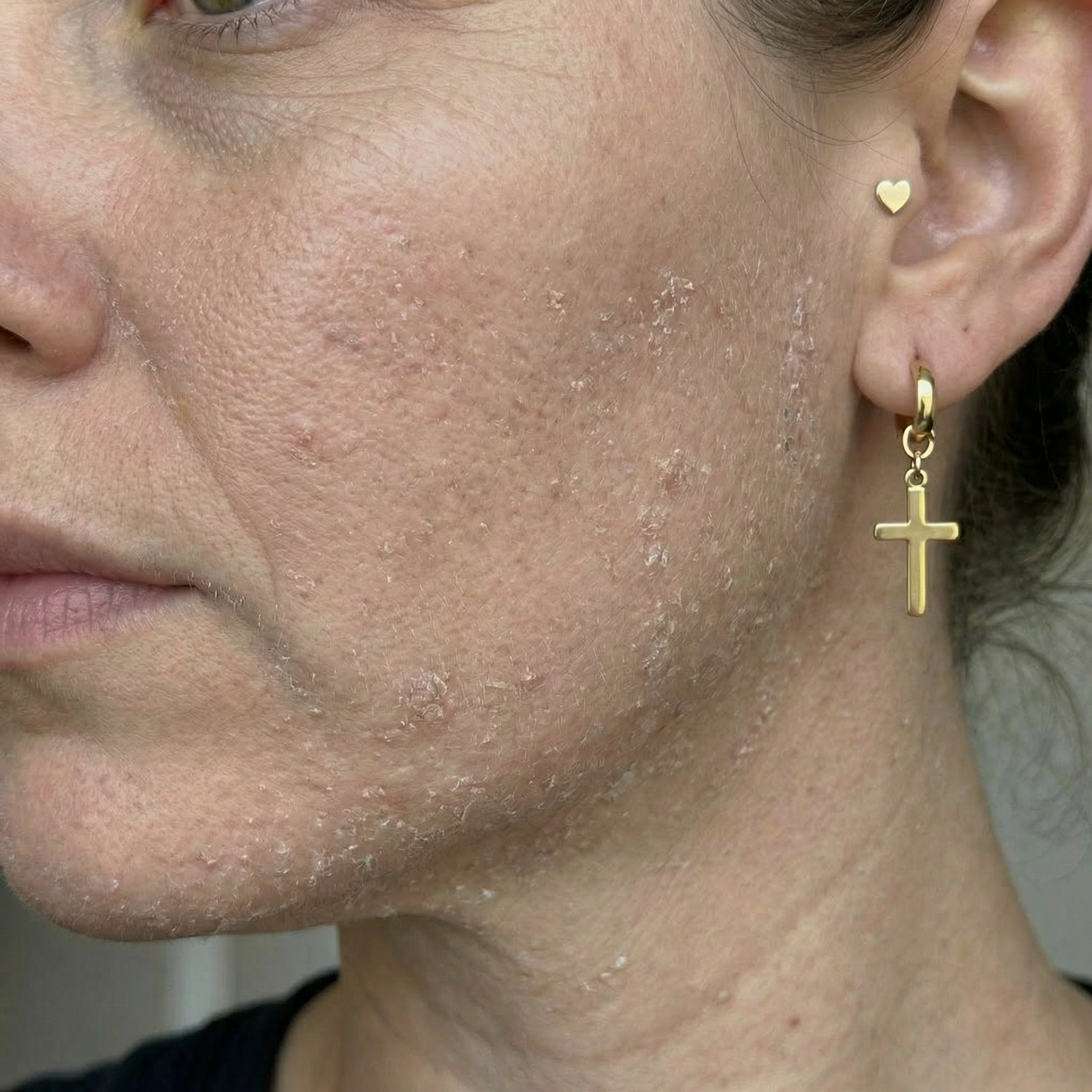 Dermly Facebook ad: I Didn’t Realize How Much My Dry Skin Was Controlling My…