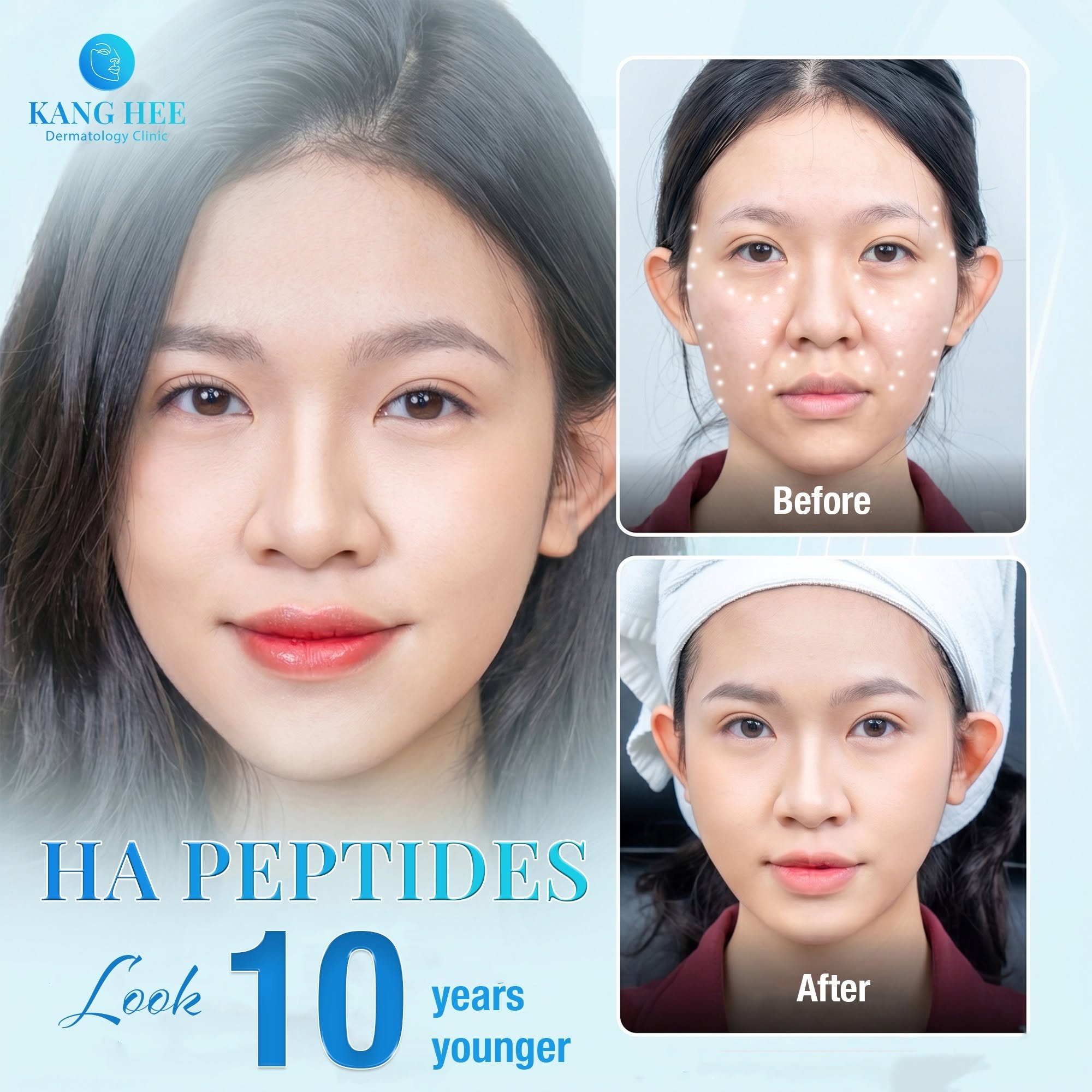 Kanghee Dermatology Clinic UAE Facebook ad: HA PEPTIDES, 30 MINUTES TO A MORE YOUTHFUL…