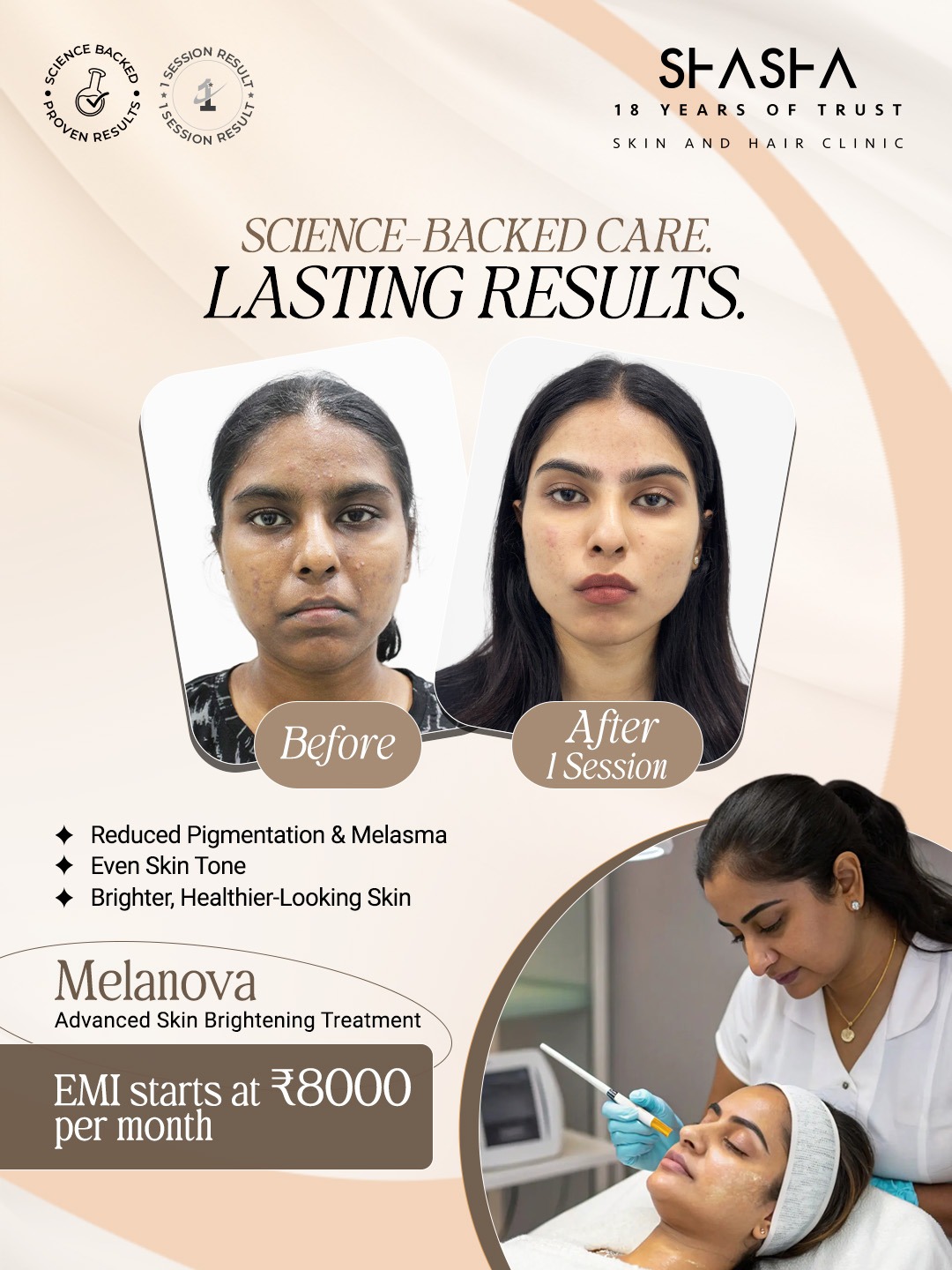 Shasha Skin And Hair Care Facebook ad: See the difference - real improvement after a…