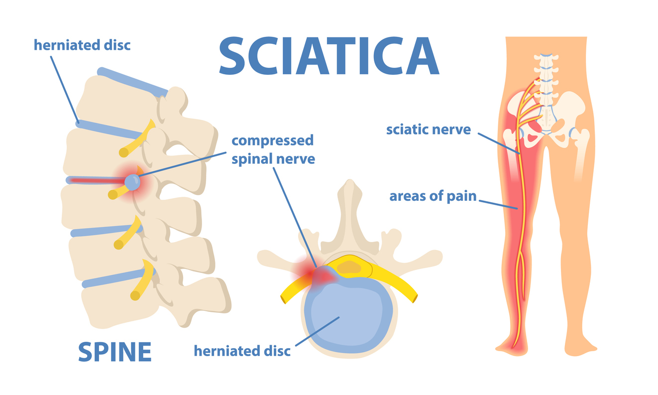 Adjusted Chiropractic Studios Facebook ad
