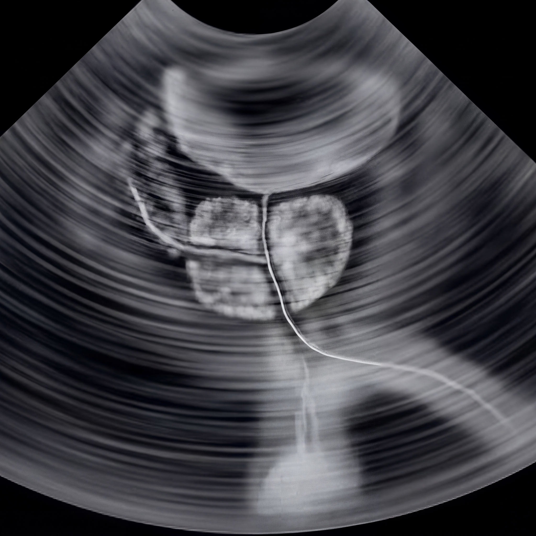 Natural Heart Magazine Facebook ad: Your Retrograde Ejaculation Is The Warning. Your Heart Is…