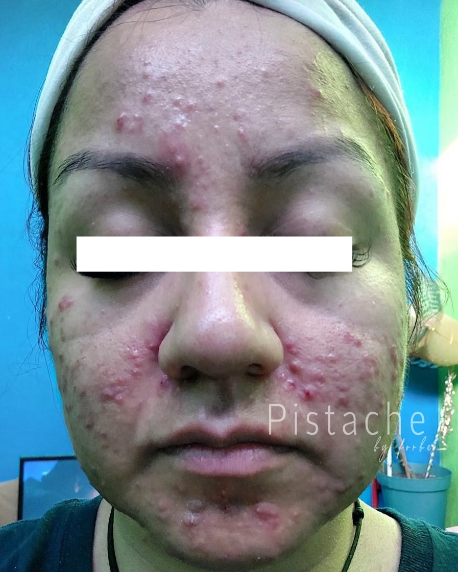 Pistache Facebook ad