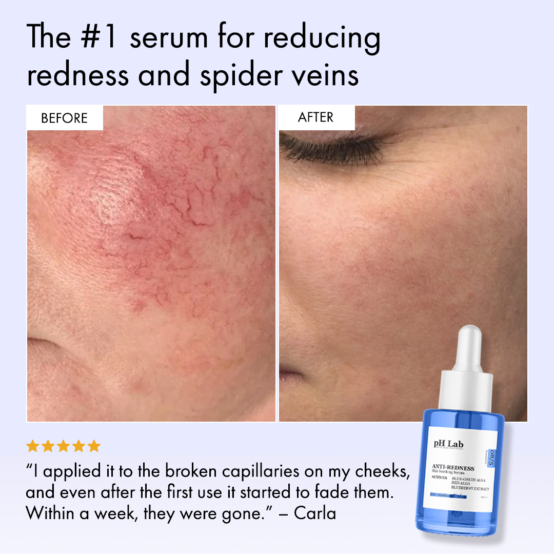 Anti-Redness US Facebook ad
