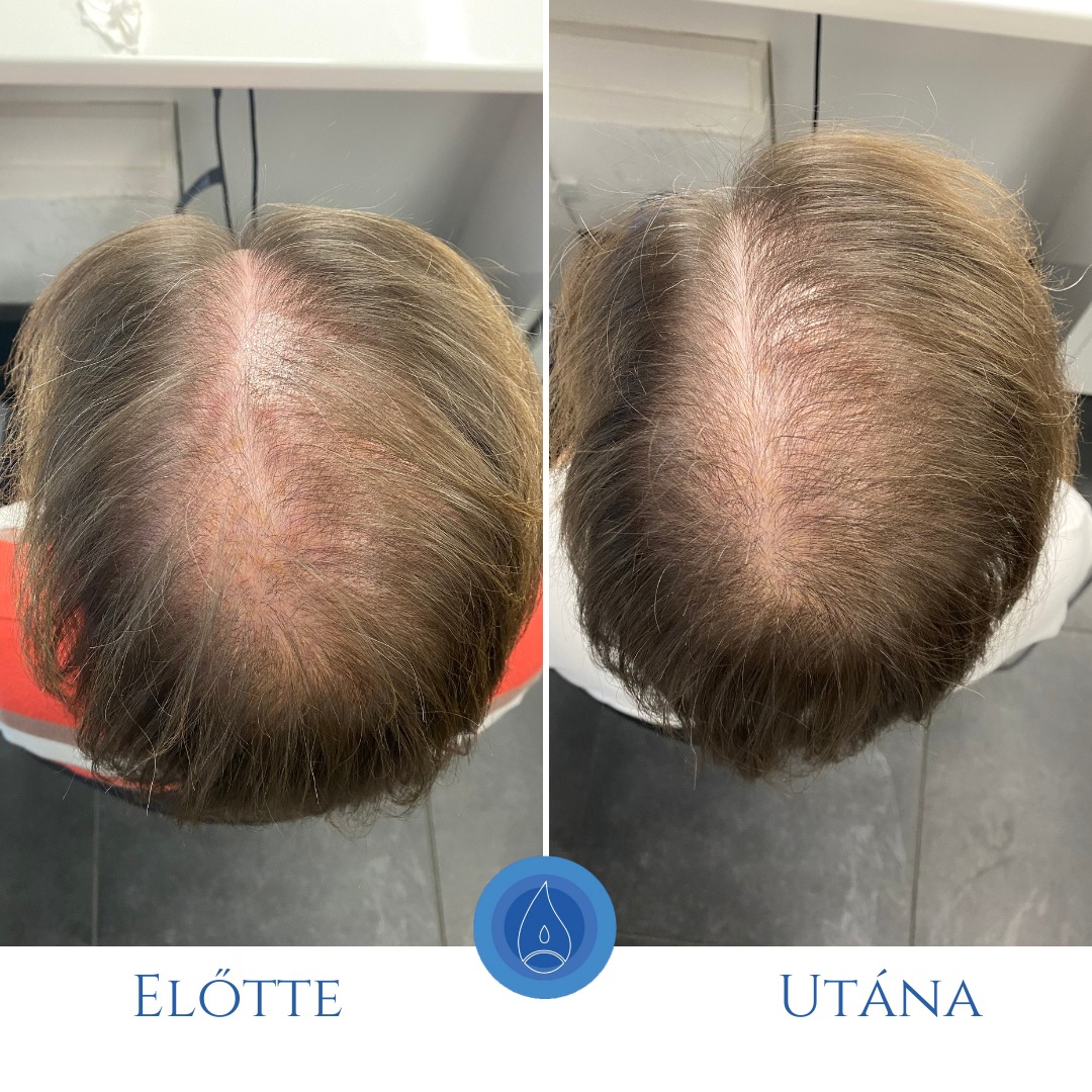 Oxygeni Hair & Skin Hajgyógyász és Bőrterápia Szalon Győr Facebook ad