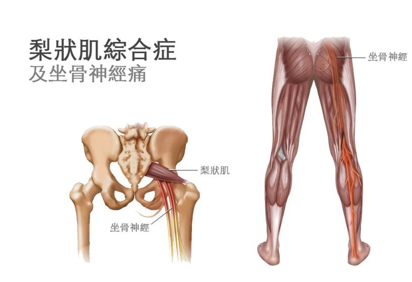上善若水中醫痛症理療中心 Mercy Chinese Medicine Clinic 筋膜痛症 Chronic Pain Treatment Facebook ad