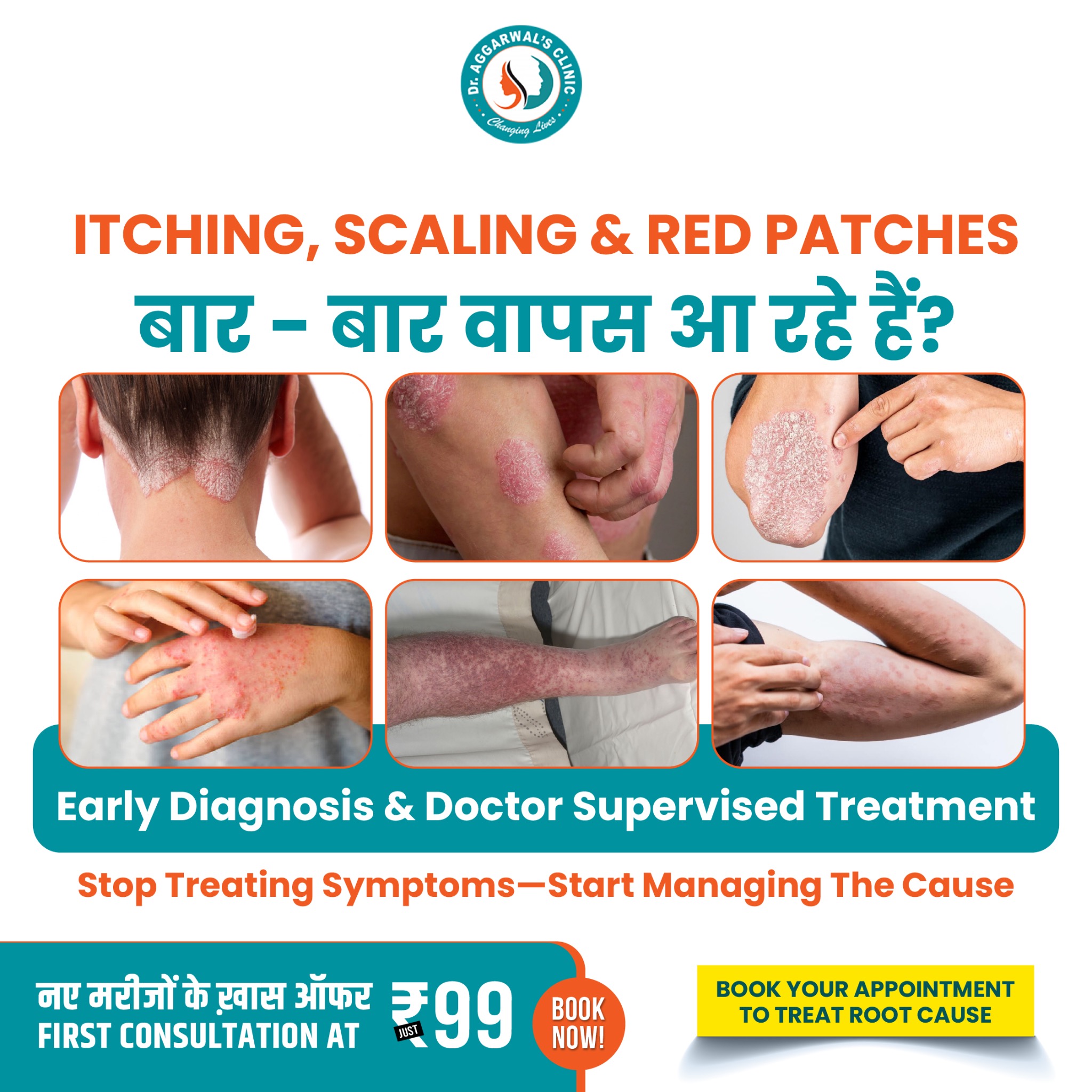Dr aggarwals hair transplant, laser treatment, cosmetic & dental center Facebook ad