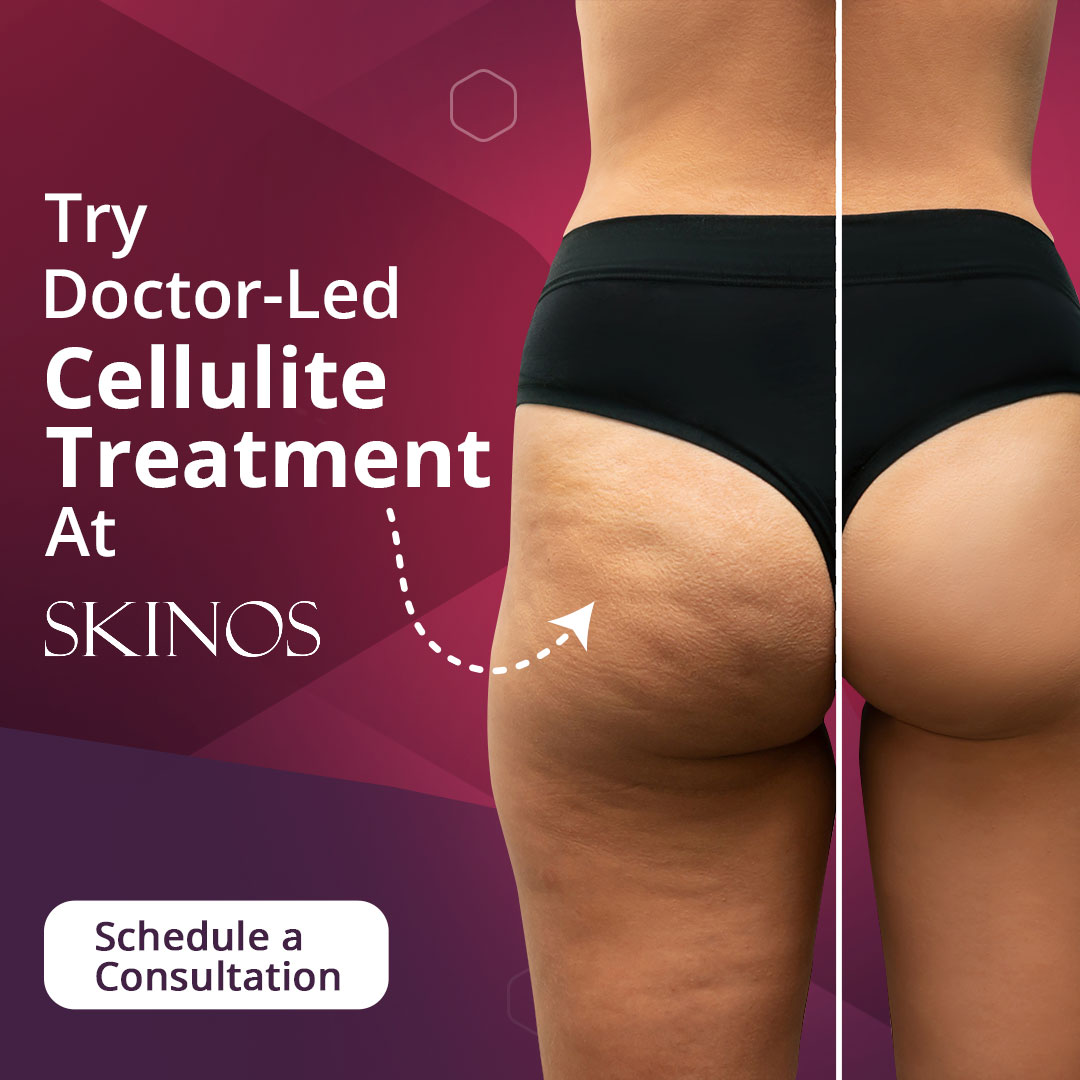 SKINOS Facebook ad
