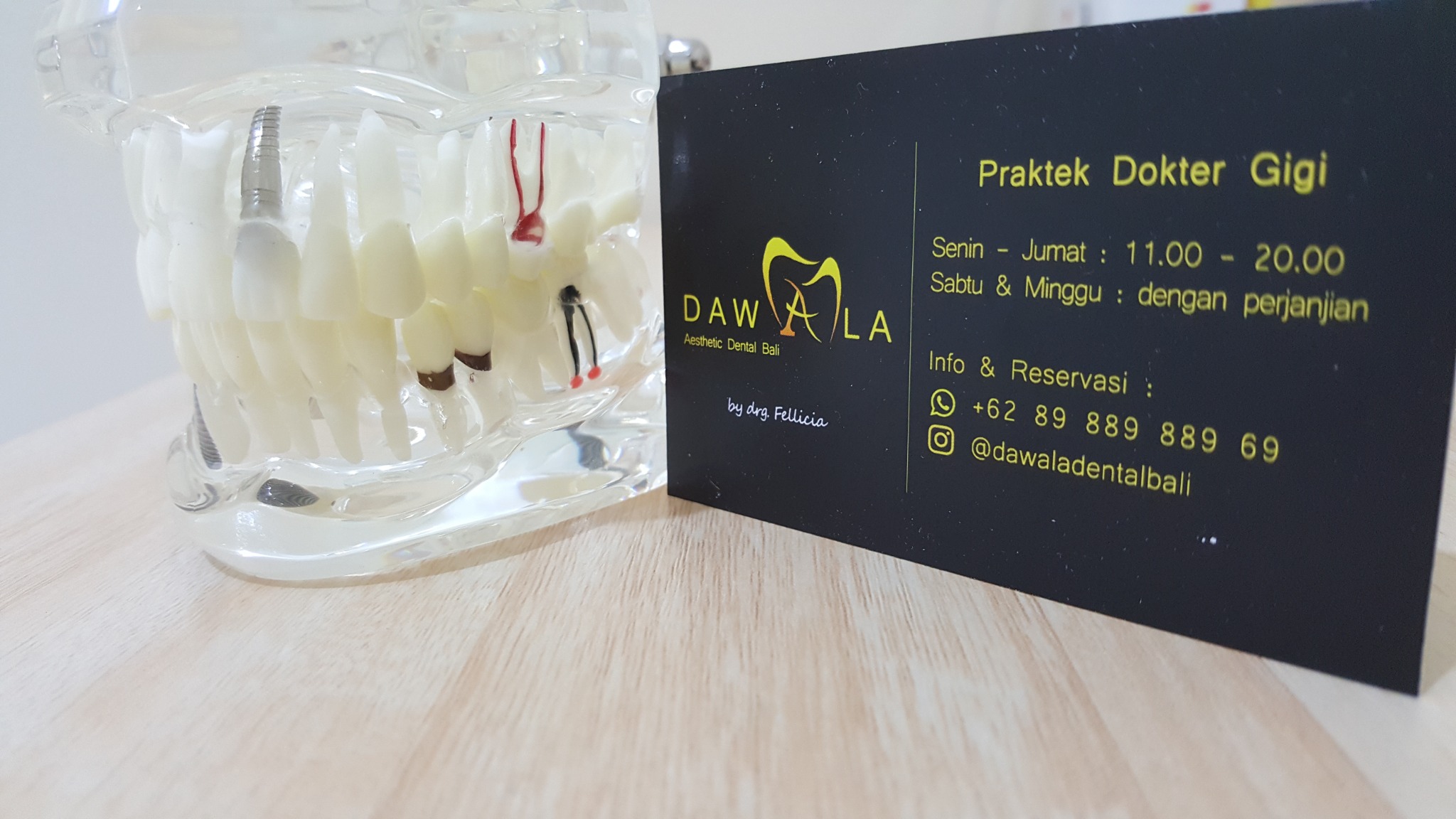Dawala Aesthetic Dental Bali Facebook ad: Click now
