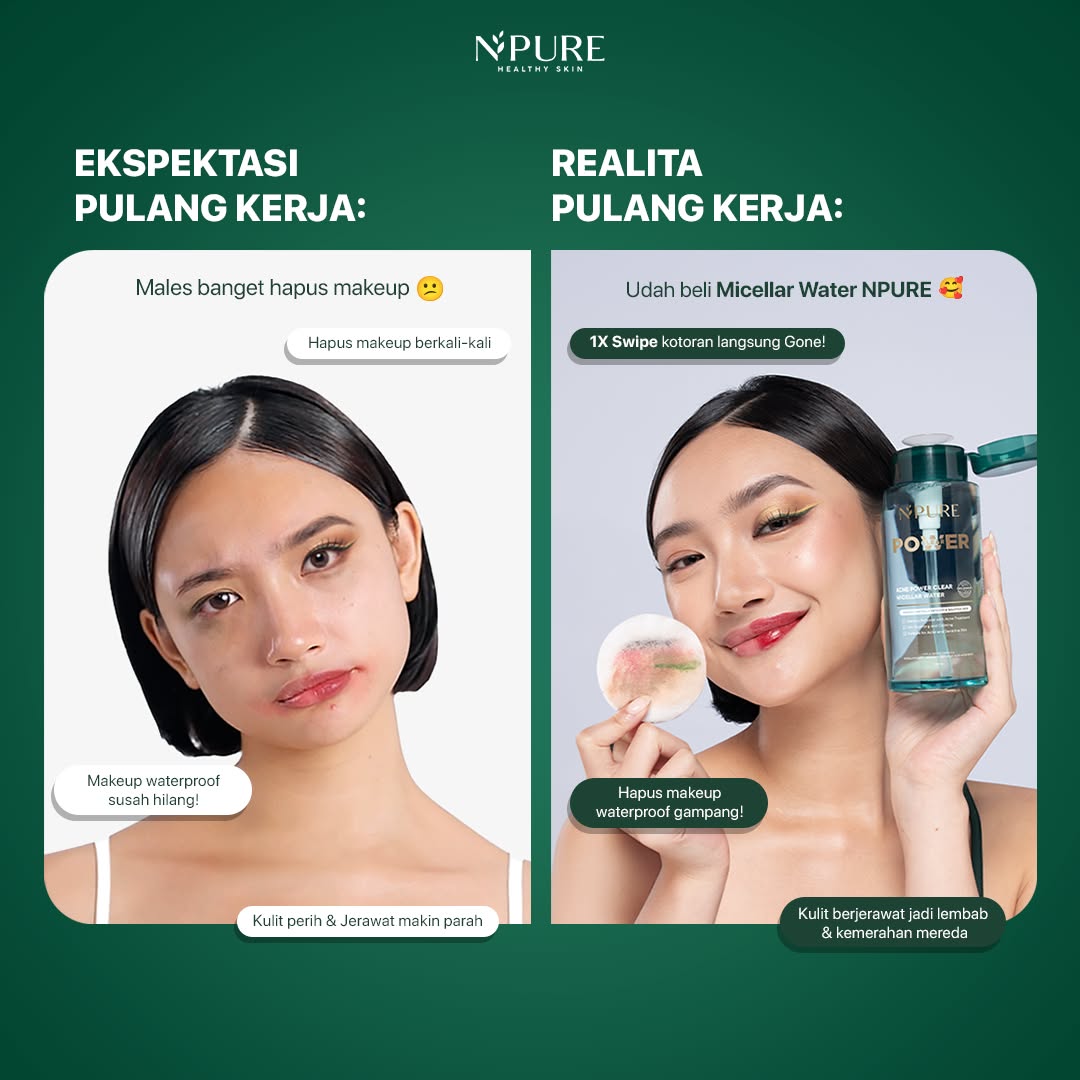 NPURE Facebook ad