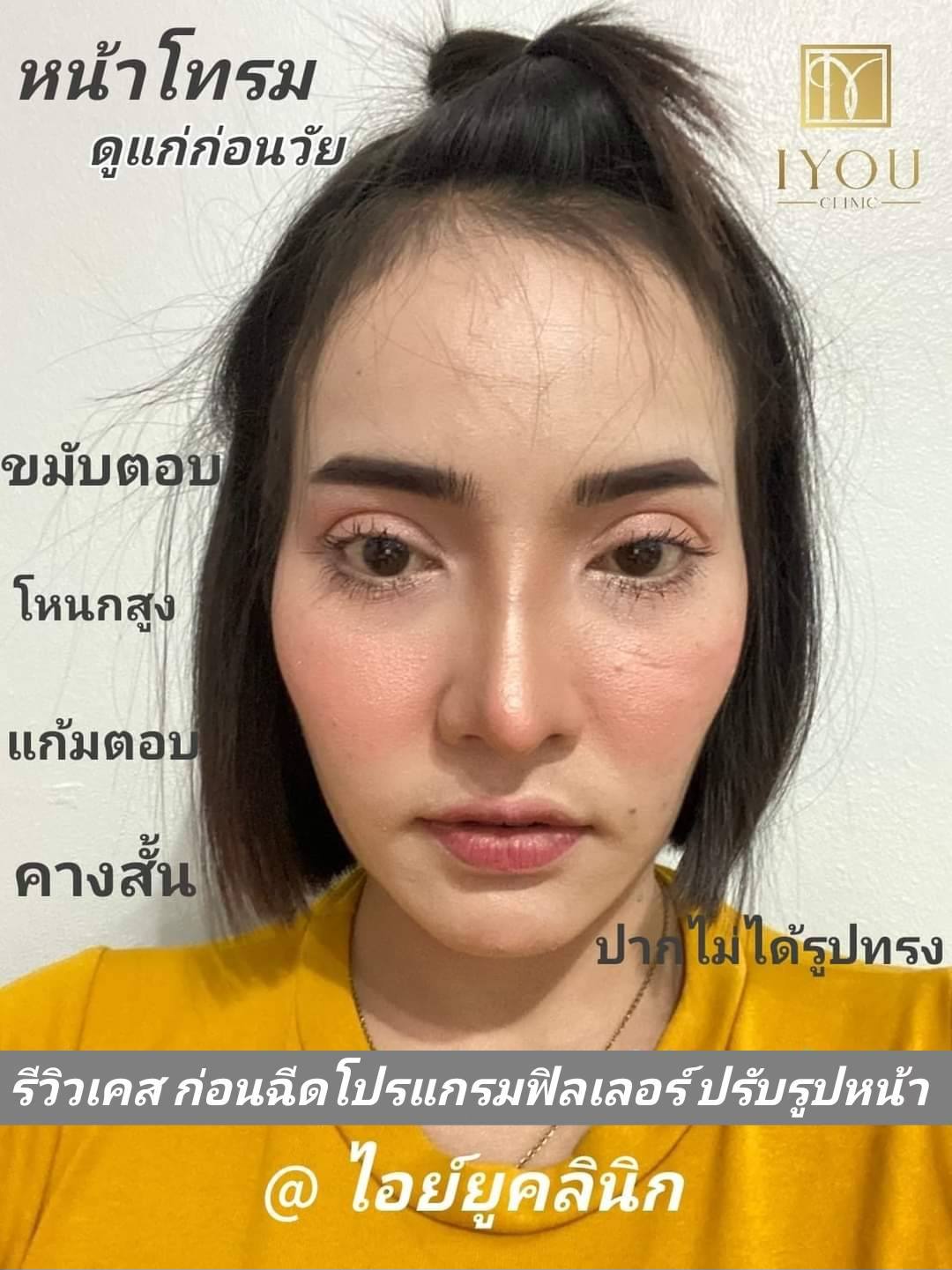 IYOU Clinic ไอย์ยูคลินิก ฉะเชิงเทรา by หมอหุ้น Facebook ad