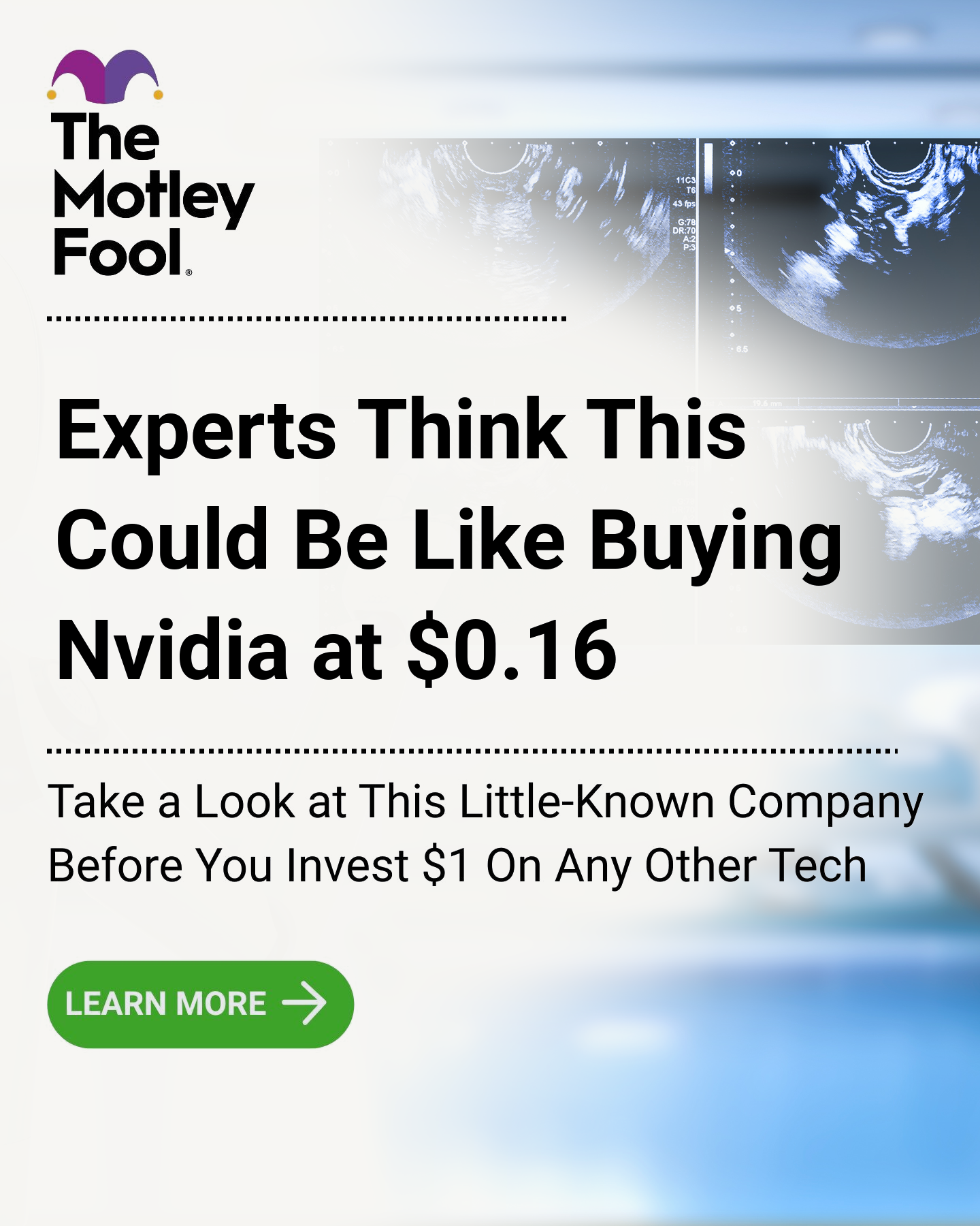 The Motley Fool Facebook ad