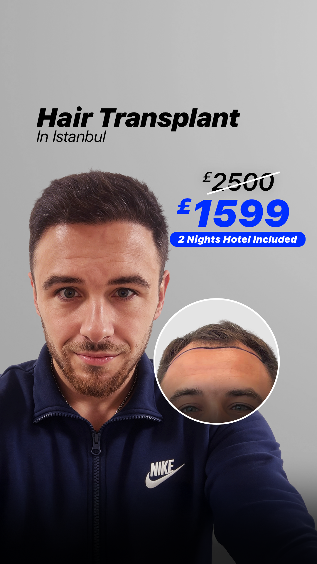 Esvita Clinic Turkey Facebook ad from Apr 24, 2026