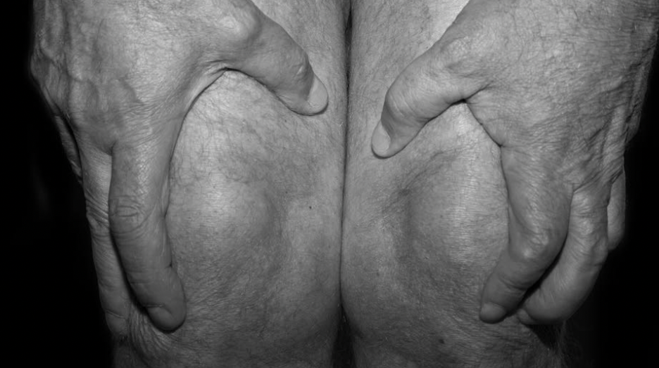 Esther Rubleck Facebook ad: They Told Me My Joints Were Just Getting Old, But a…