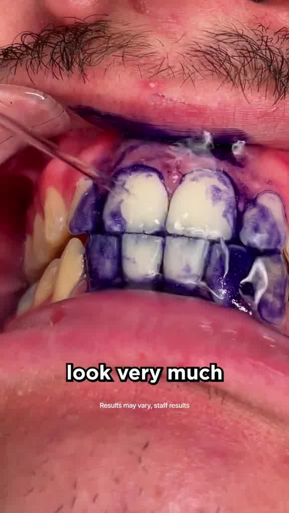 Hi-Smile Dental Care PH Facebook ad from Oct 9, 2024