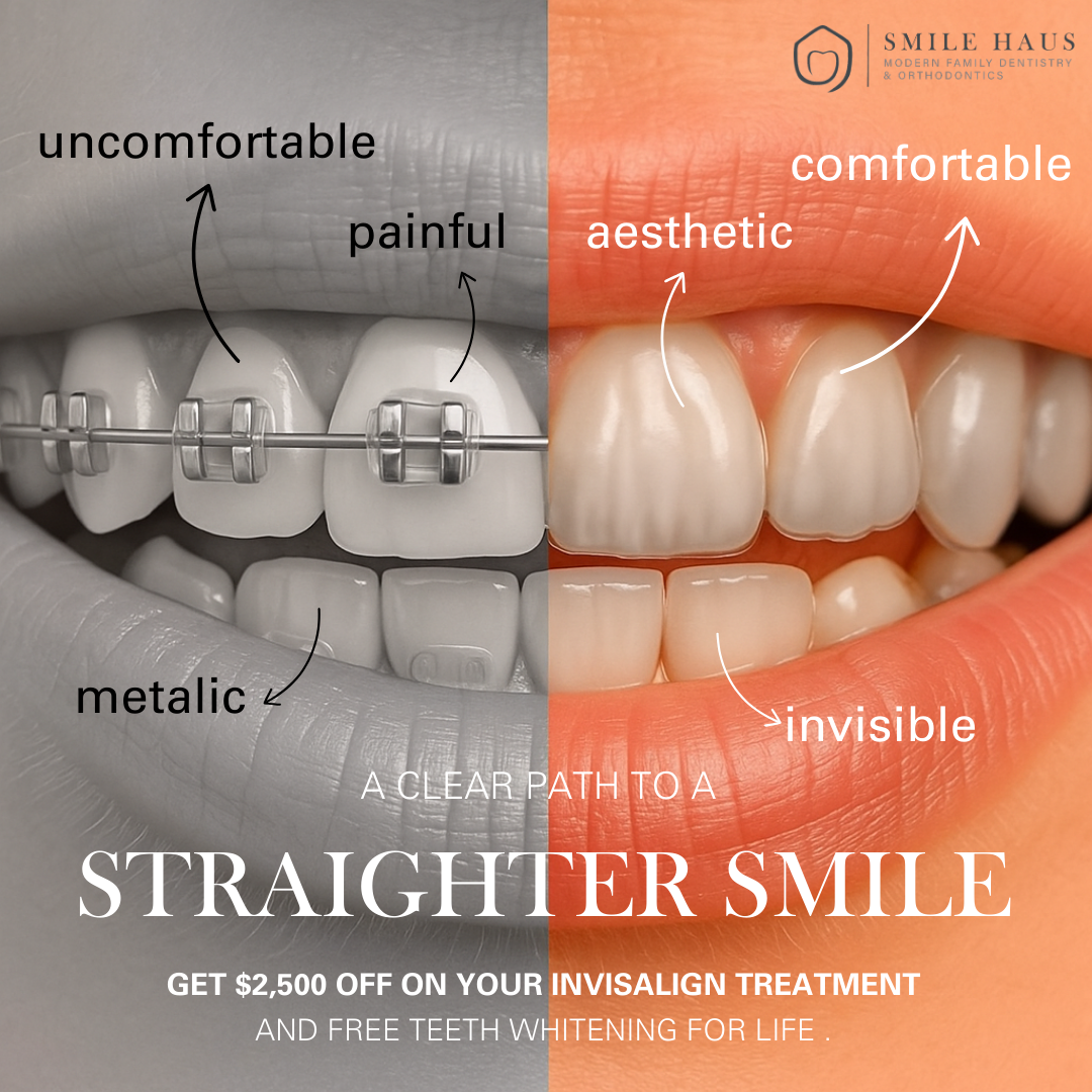 Smile Haus Facebook ad