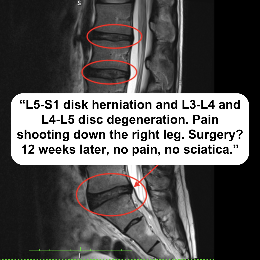 Postureletics - Back Pain Relief Facebook ad: Discover How to Relieve Back Pain, Take the Test