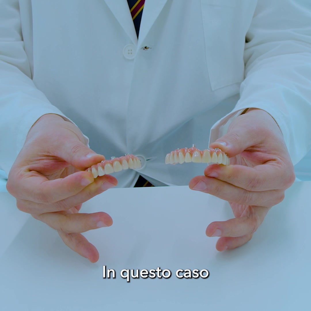 Prof. Mario R. Cappellin Facebook ad: Denti fissi in 24 ore! Prenota ora!