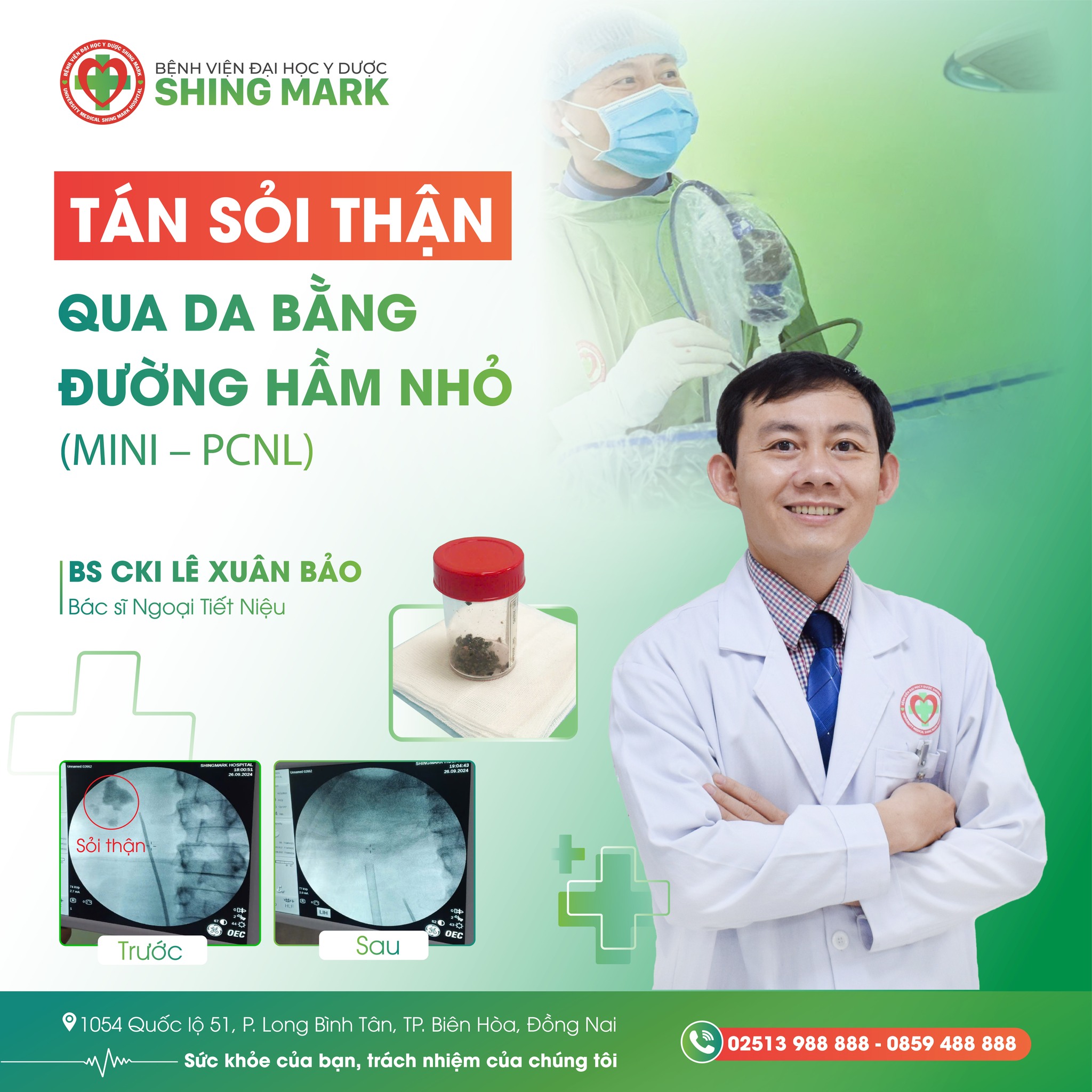 Bệnh Viện Đại Học Y Dược Shing Mark Facebook ad: QUA DA BẰNG ĐƯỜNG HẦM NHỎ (MINI, PCNL)