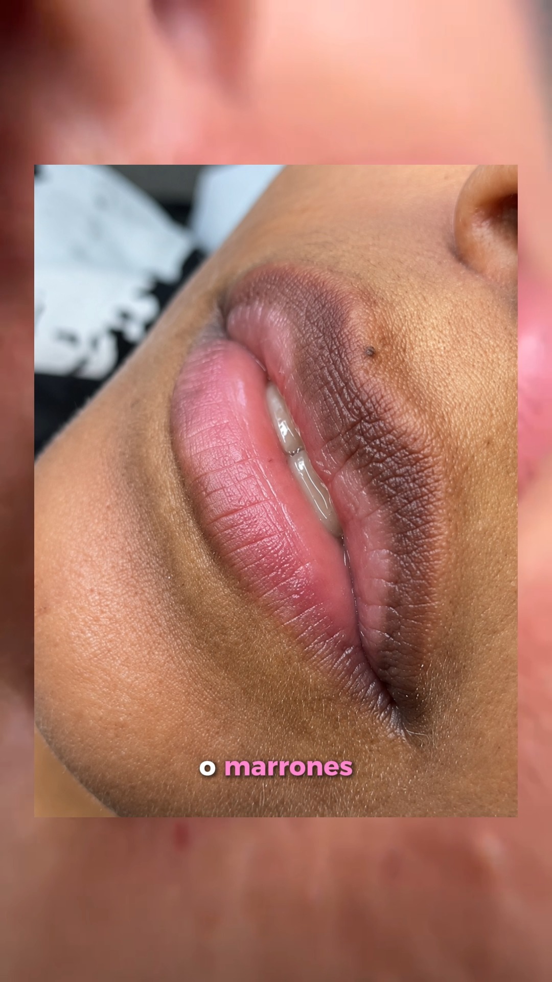 Greeis Salón Spa Facebook ad: QUE PROBLEMAS AYUDA A MEJORAR LA DE?