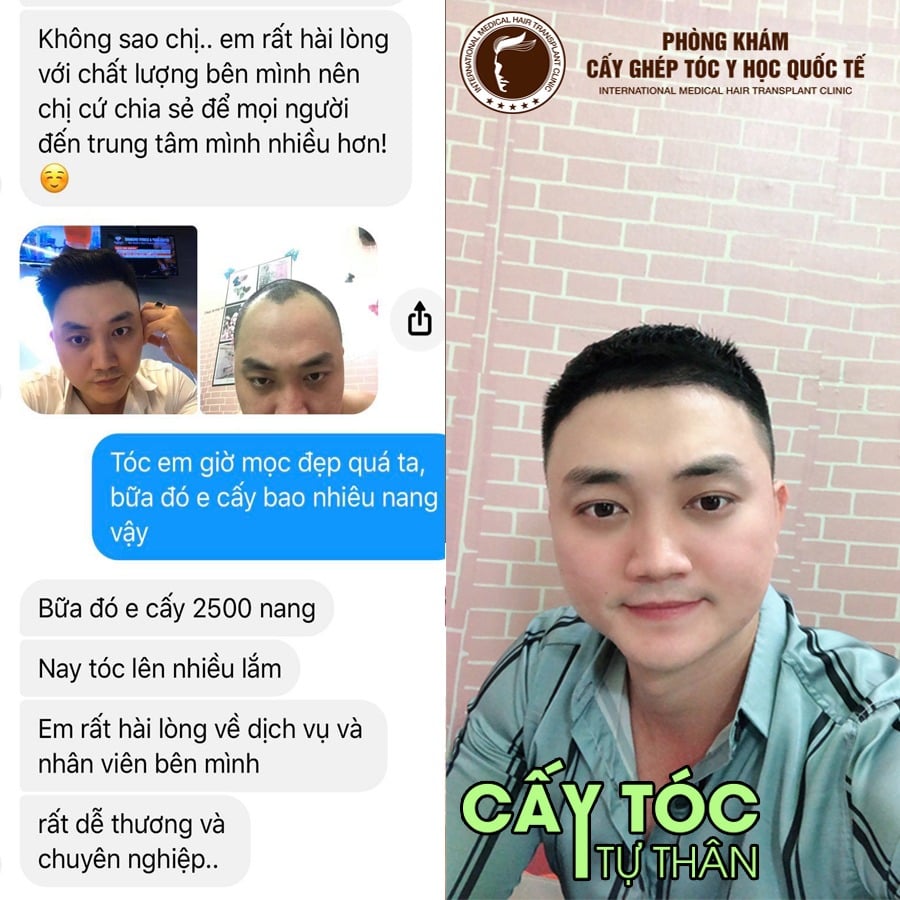 Cấy Tóc Y Học Quốc Tế Hồ Chí Minh - Hair Transplant Clinic Facebook ad: Cam Kết Hoàn Tiền Nếu không Hiệu Quả >>>>>
