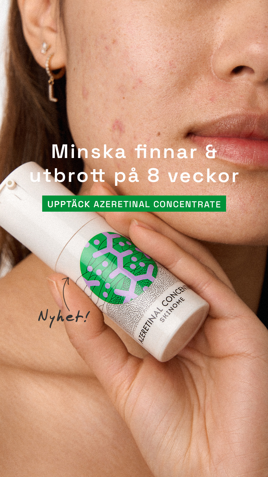 Skinome Facebook ad