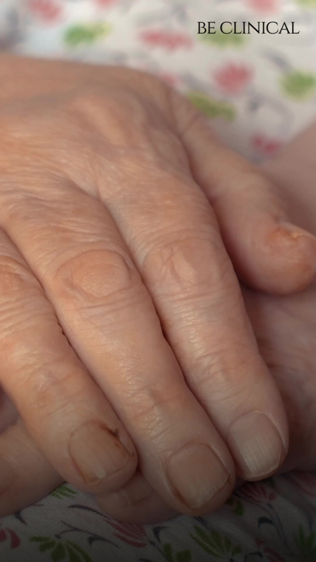 Be Clinical Facebook ad: Say Goodbye to Dry, Wrinkled Hands, Hello Youthful Softness!