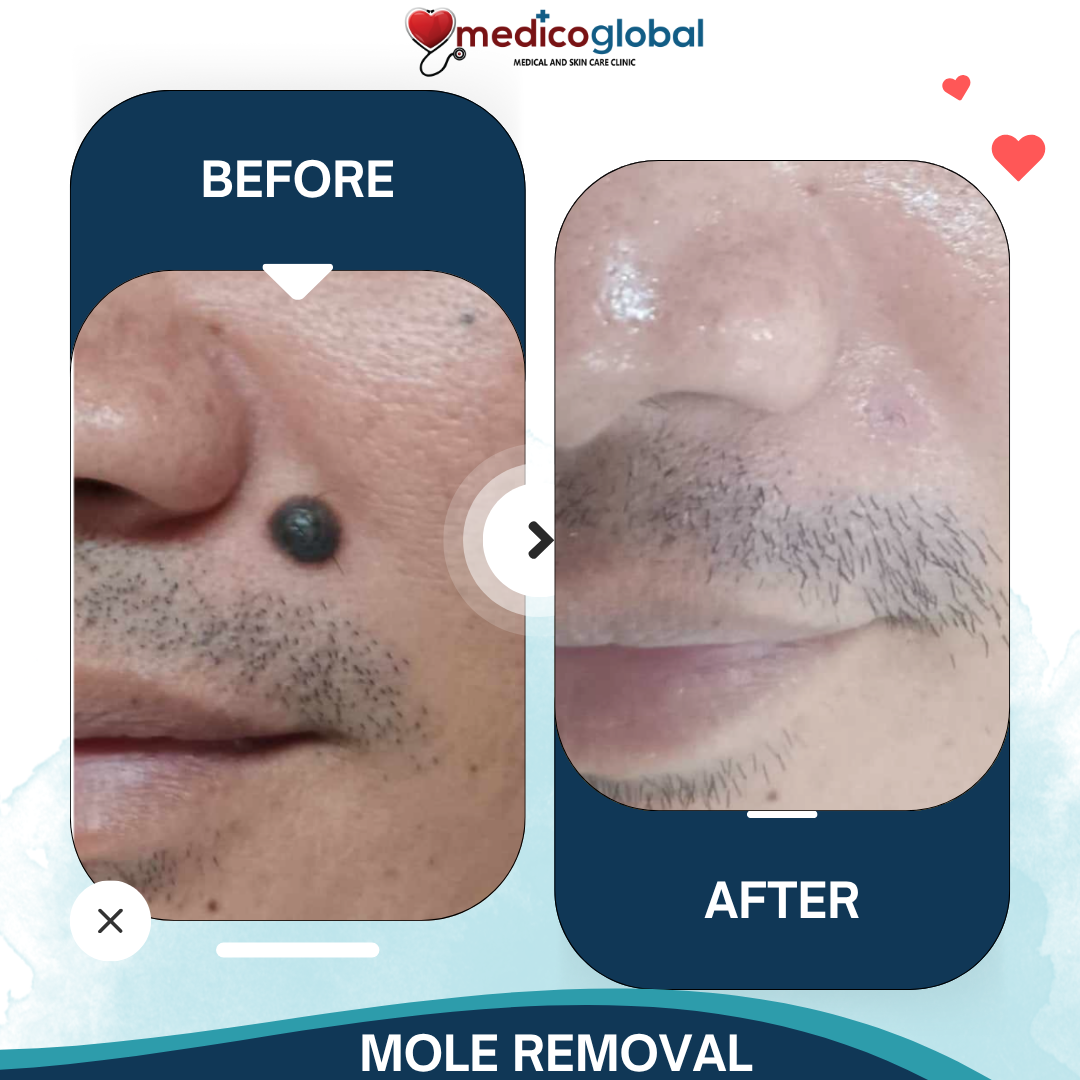 Medico Global Clinic Timog Ave. QC Branch - Medical and Skin Care Clinic Facebook ad: Chat on Messenger