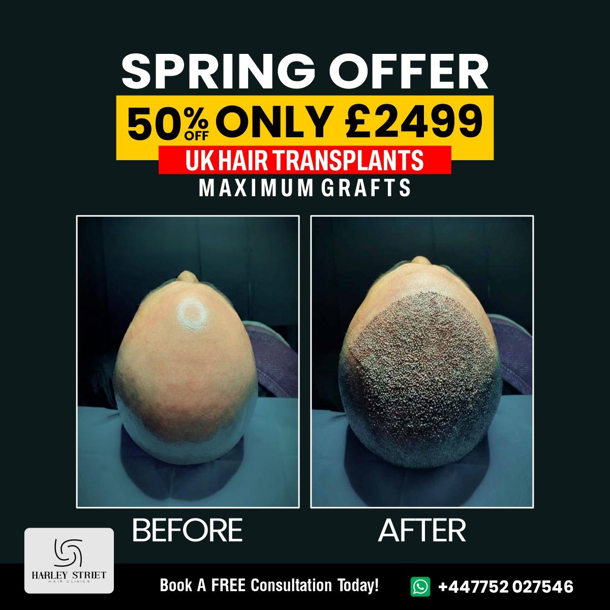 Harley Street Hair Clinics Facebook ad