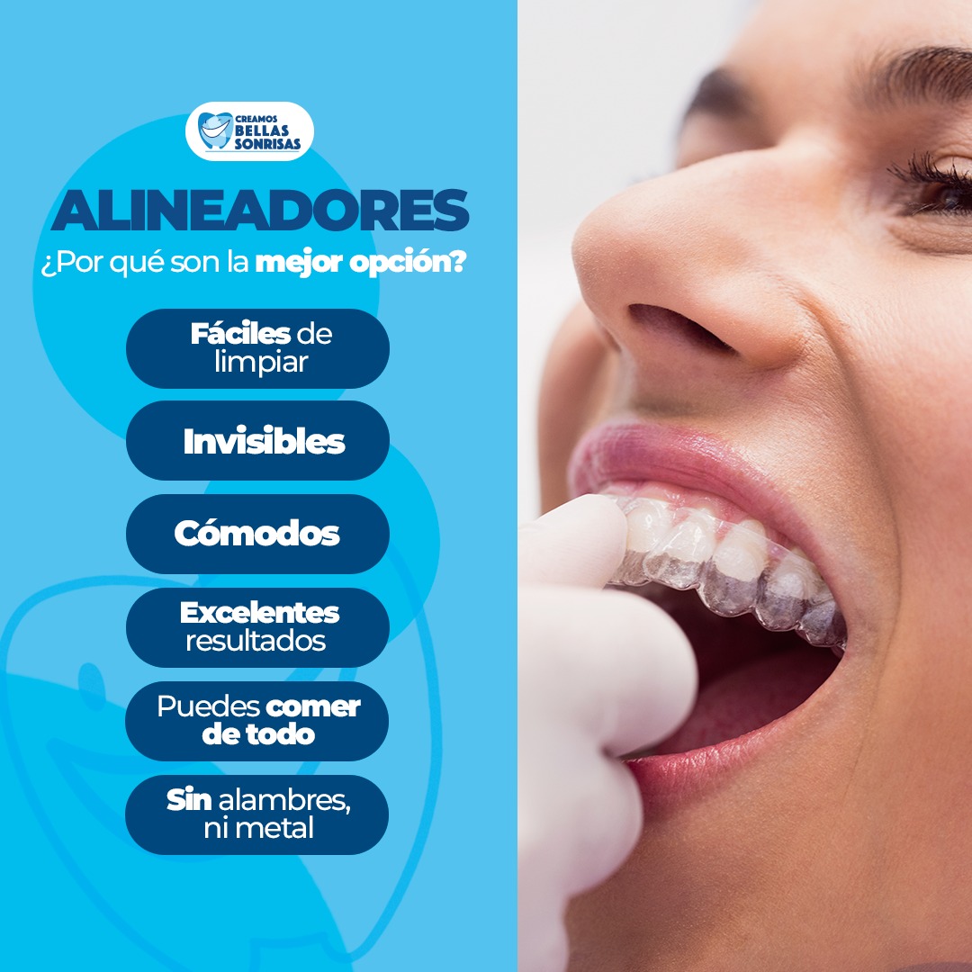 Creamos Bellas Sonrisas Facebook ad: Beneficios de los alineadores dentales