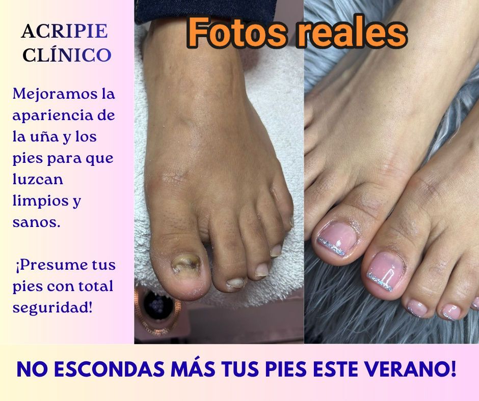America Beauty Bar Facebook ad: No escondas más tus pies este verano!