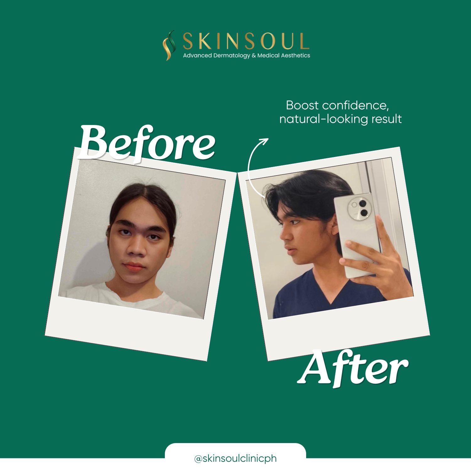 SkinSoul Advanced Dermatology and Medical Aesthetics - Mandaluyong Facebook ad