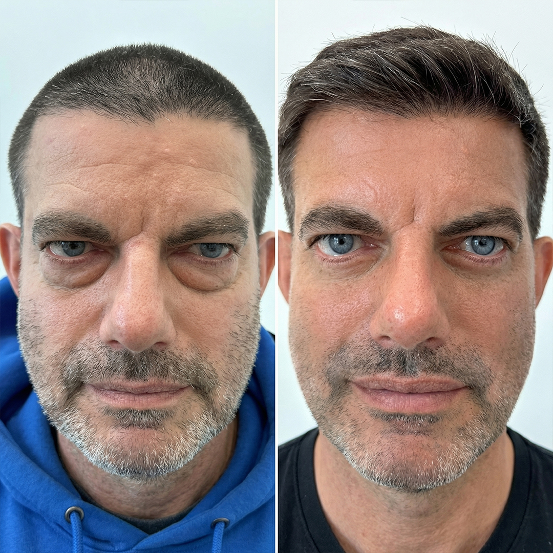 Men's Skincare Tips Facebook ad