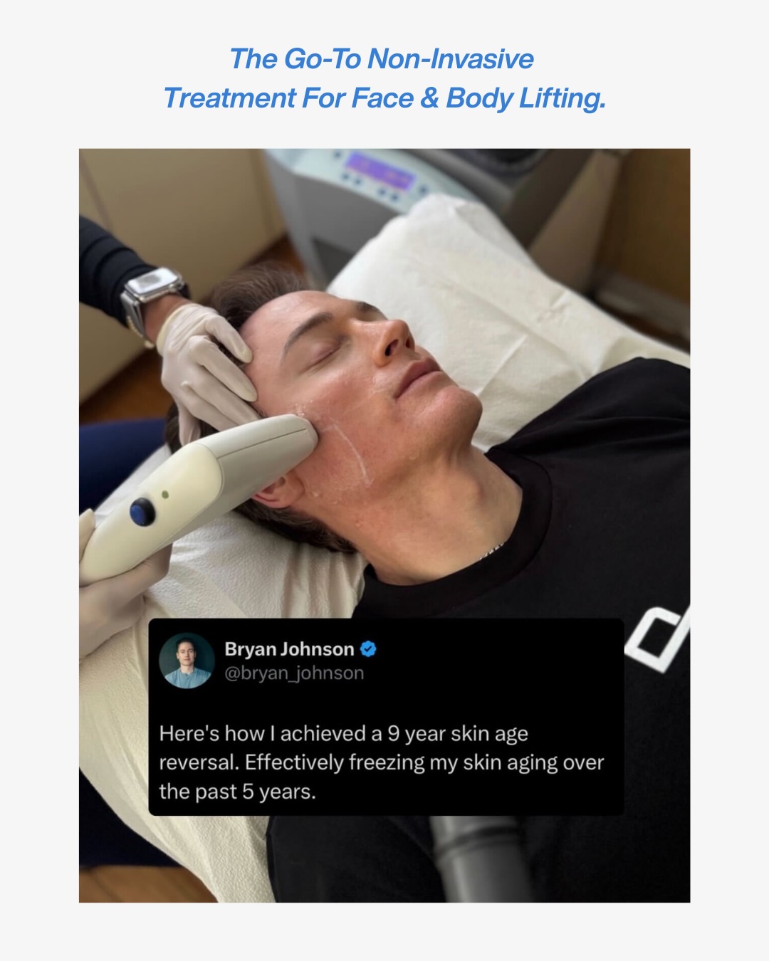 Sofwave Facebook ad