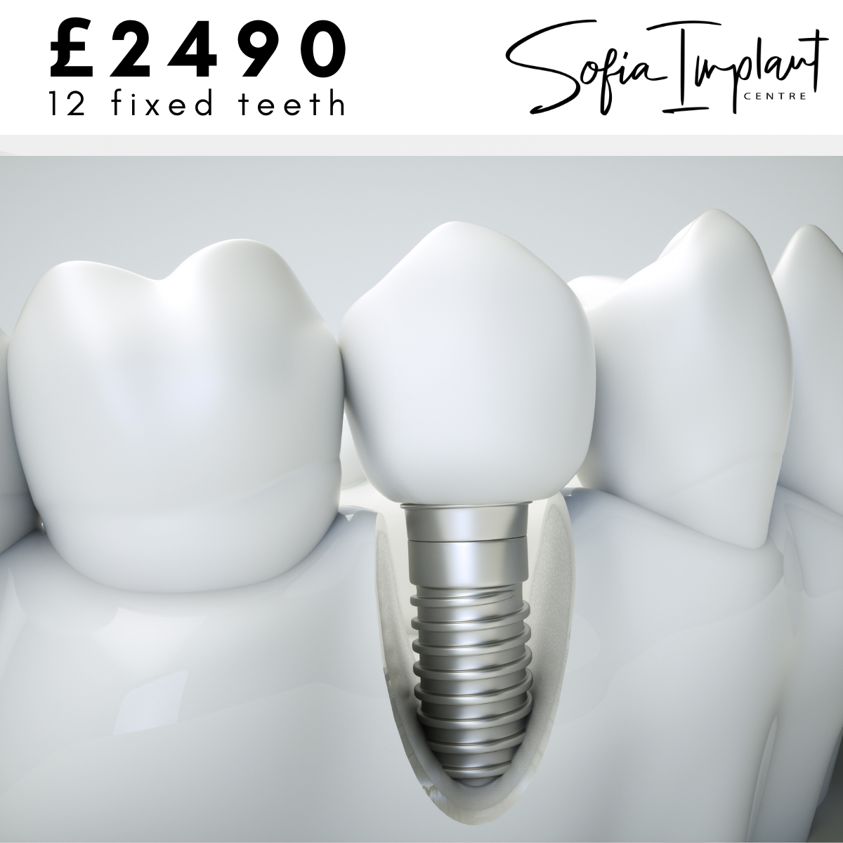 Sofia Implant Centre Facebook ad