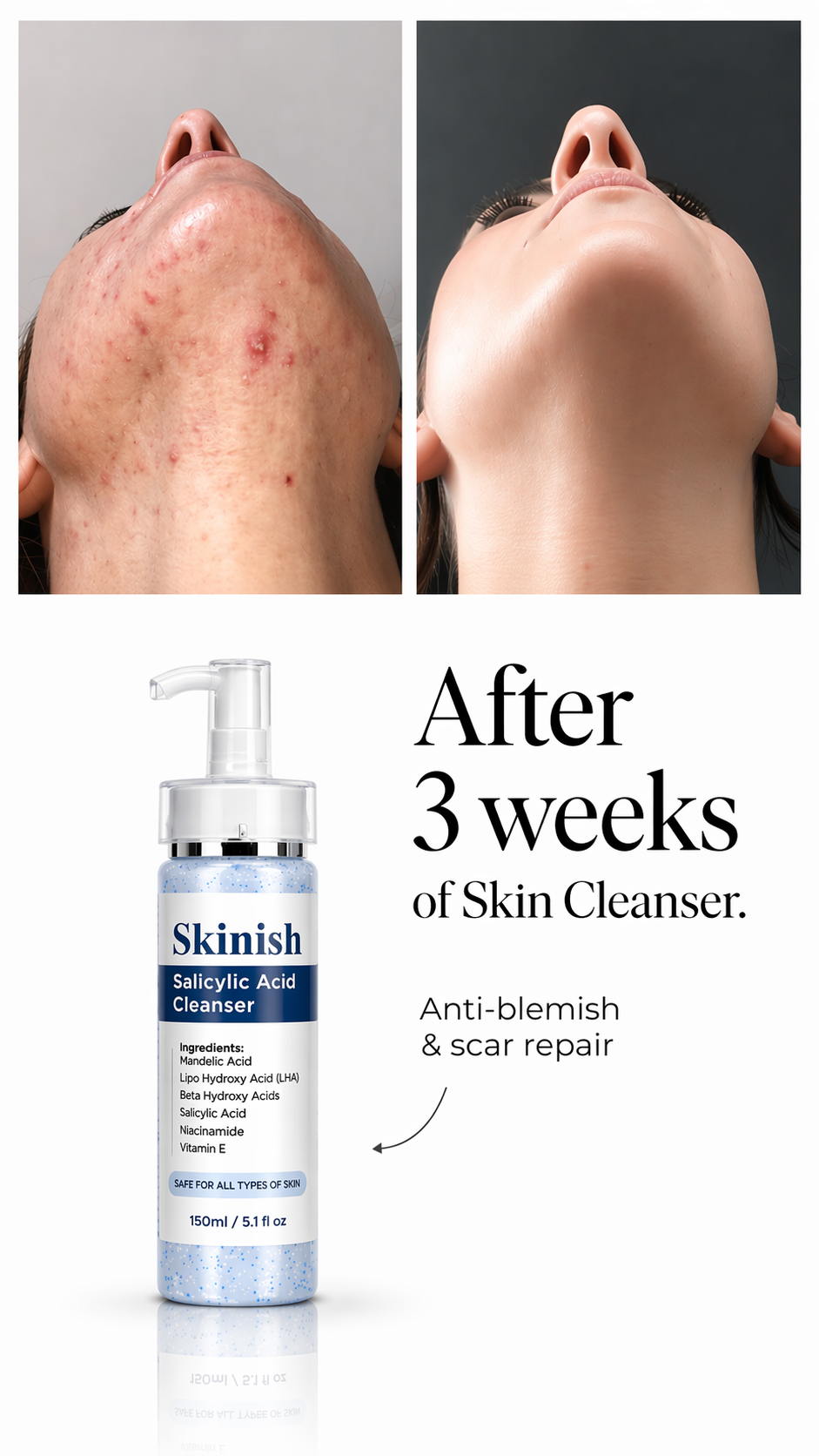 Skinish Facebook ad: Results in 14 days or your money back