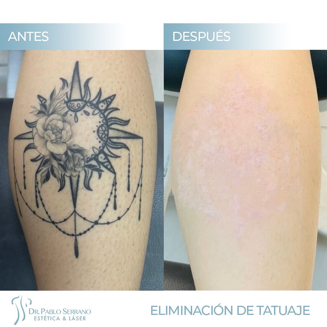 Dr. Pablo Serrano, Medicina Estética Facial. Facebook ad