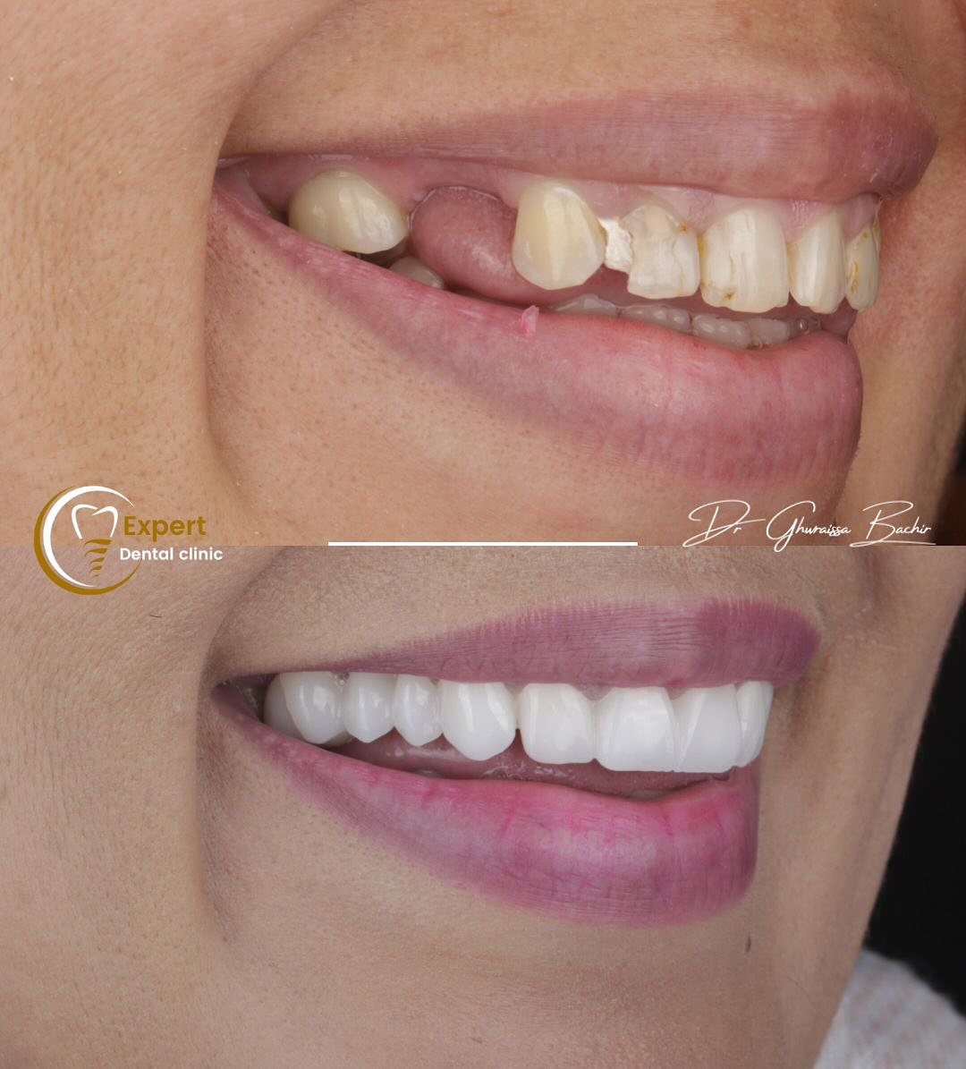Expert Dental Clinic Alger Facebook ad: نهتم بأدق التفاصيل ونجتهد لنصنع أفضل الإبتسامات.