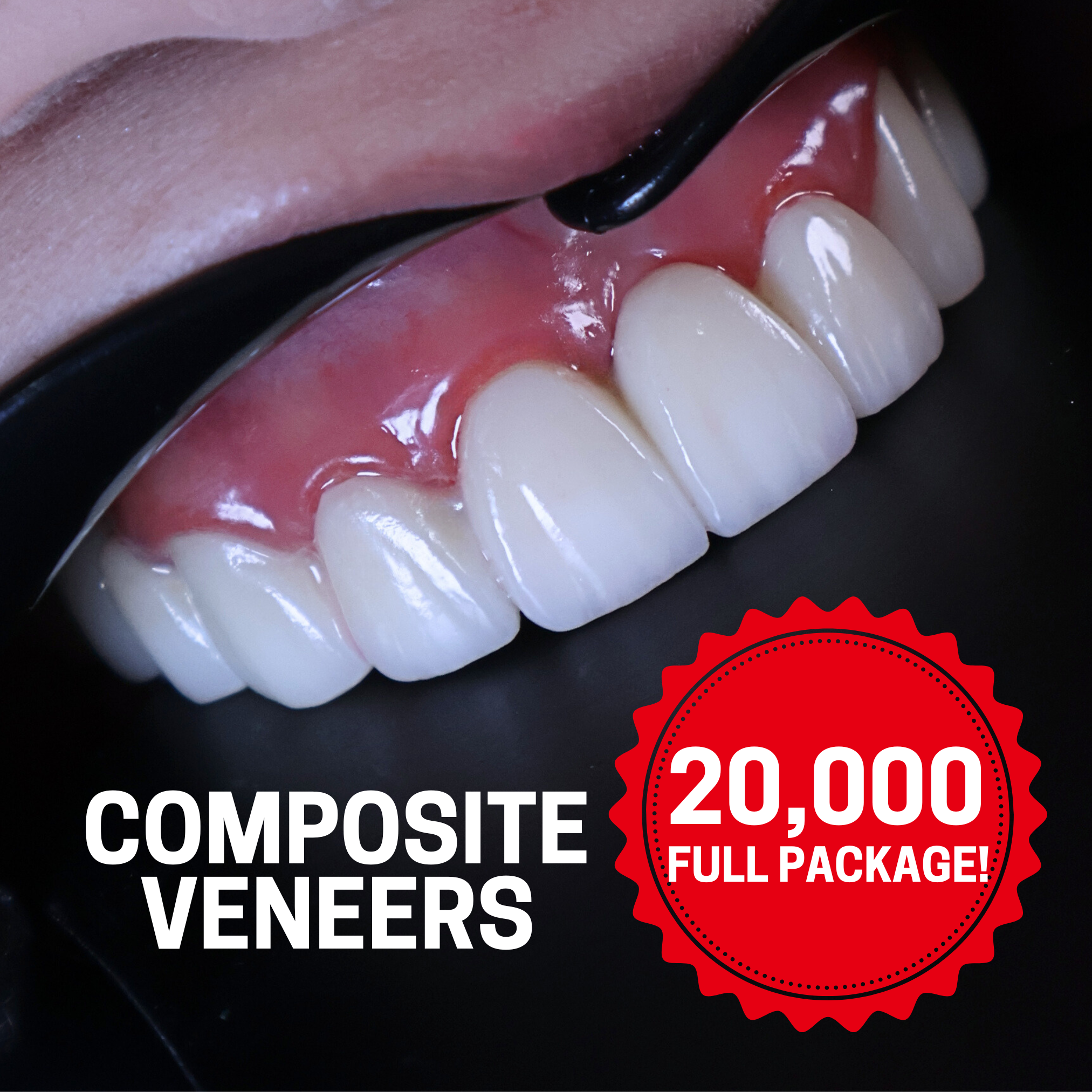 Ivory Smile Dental Clinic - Pasig Branch Facebook ad