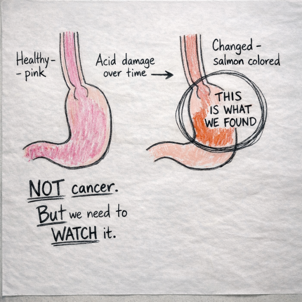 My Esophagus and Me Facebook ad