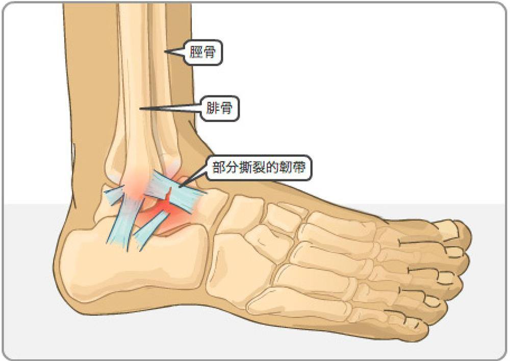 上善若水中醫痛症理療中心 Mercy Chinese Medicine Clinic 筋膜痛症 Chronic Pain Treatment Facebook ad